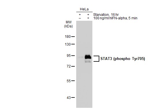 STAT3 (phospho Tyr705) antibody [GT1204]