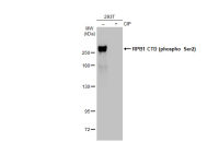 RPB1 CTD (phospho Ser2) antibody [GT1302]