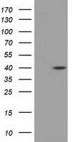 DHPS antibody [2C9]