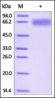 Human ILT-4 protein, His tag (active)