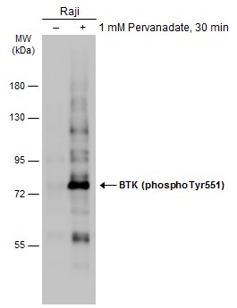 BTK (phospho Tyr551) antibody