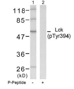 Lck (phospho Tyr394) antibody