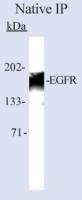 EGFR antibody [199.12]