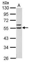 Retinoid X Receptor alpha antibody