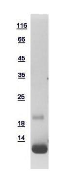 Human TRIAP1 protein, His tag