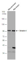 Striatin 4 antibody