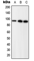 Progesterone Receptor (phospho Ser294) antibody
