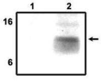 DAP12 antibody