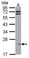 RPL11 antibody