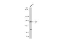 Gli1 antibody