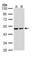PPM1A antibody