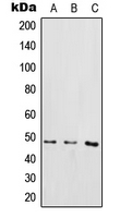 IKK gamma (phospho Ser85) antibody