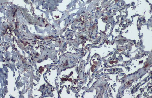 ACE2 antibody [N1N2], N-term产品图