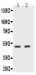 CD2 antibody