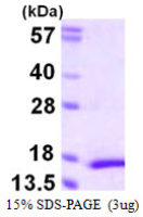 Human MYL5 protein, His tag