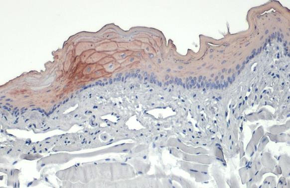 Cytokeratin 19 antibody [N1C1]