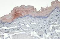 Cytokeratin 19 antibody [N1C1]