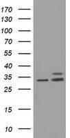 CYB5R3 antibody [1E3]