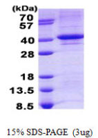 Human TDP1 protein, His tag
