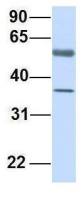 EMI1 antibody, C-term