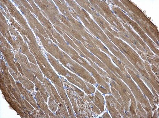 Creatine kinase (muscle) antibody [N2C3]
