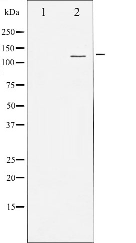 PKD1/2/3/PKC micro antibody