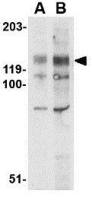 BUB1 antibody