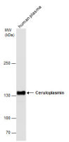 Ceruloplasmin antibody [N1N2], N-term