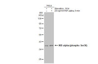 IKB alpha (phospho Ser36) antibody [GT1298]