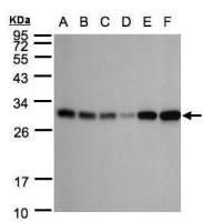 Adenylate kinase 4 antibody [N1C3]