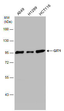 GIT1 antibody