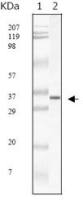 SARS-CoV M antibody [2H2C4]