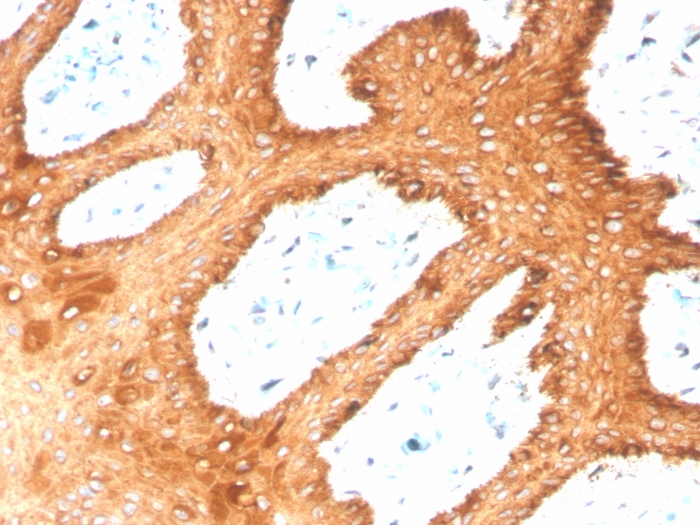 Cytokeratin 2 antibody [KRTH/4392R]