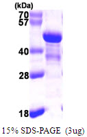 Human NDE1 protein, His tag