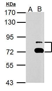 TTC39B antibody