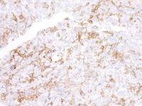 PD-L1 antibody [IHC411]