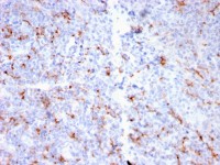S100A8 + S100A9 antibody [MAC3157R]