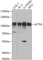 alpha Actinin 1 antibody