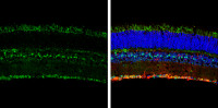 Opsin 5 antibody [N2C1], Internal