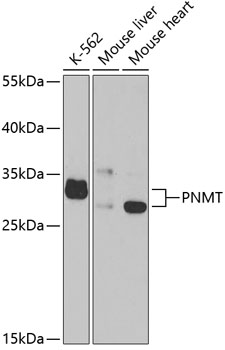 PNMT antibody