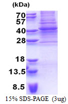 Human PAX9 protein, His tag