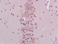 BHLHB9 antibody
