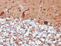 PGP9.5 antibody [UCHL1/4556R]