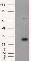 NIT1 antibody [3A11]