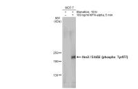 Her2 / ErbB2 (phospho Tyr877) antibody