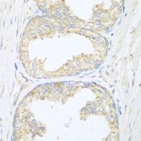 beta Sarcoglycan antibody
