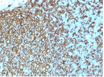 MHC Class II antibody [rHLA-Pan/3475]