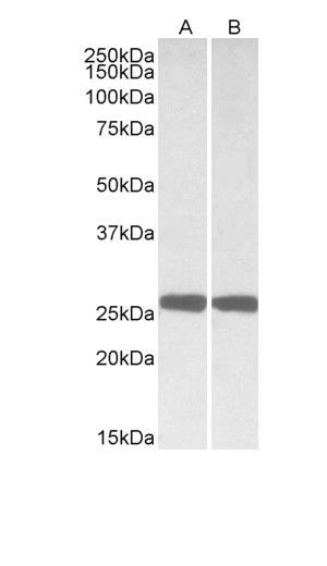 PGP9.5 antibody, Internal