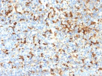 TRP1 antibody [TYRP1/2340R]