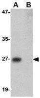 PRTFDC1 antibody